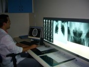 Eficiencia energética en hospitales de Santa Catarina