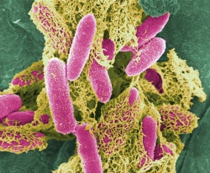 Putting bacteria into butanol production