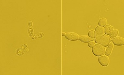 Researchers in US convert yeast cells into ‘sweet crude’ biofuel