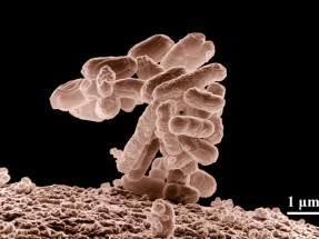 Investigadores diseñan genéticamente la bacteria E. coli y logran que se convierta en una célula solar